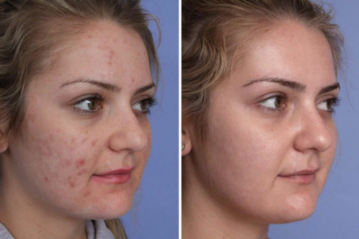 What Is Clinmax Gel 20gm? Benefits, Usage & Safety Guide